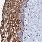 Immunohistochemical staining of human cervix shows strong nuclear/cytoplasmic positivity in squamous epithelial cells with additional membranous positivity.