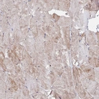 Immunohistochemical staining of human skeletal muscle shows weak cytoplasmic positivity in myocytes.