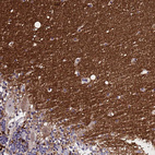Immunohistochemical staining of human cerebellum shows strong cytoplasmic positivity in cells in molecular layer.