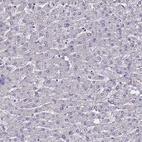 Immunohistochemical staining of human liver shows no positivity in hepatocytes as expected.