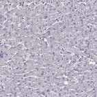 Immunohistochemical staining of human liver shows no positivity in hepatocytes as expected.