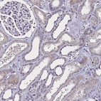 Immunohistochemical staining of human kidney shows no positivity in cells in tubules as expected.