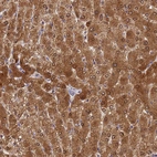Immunohistochemical staining of human liver shows moderate to strong cytoplasmic positivity in hepatocytes.