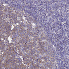 Anti-GCHFR Antibody