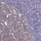 Immunohistochemical staining of human tonsil shows weak to moderate cytoplasmic positivity in germinal center cells.