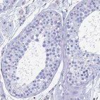 Immunohistochemical staining of human testis shows no positivity in cells in seminiferous ducts as expected.
