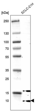 Western blot analysis in human cell line SCLC-21H.