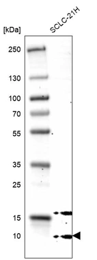 Western blot analysis in human cell line SCLC-21H.