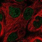 Immunofluorescent staining of human cell line CACO-2 shows localization to nucleoplasm.