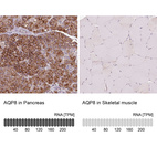 Anti-AQP8 Antibody