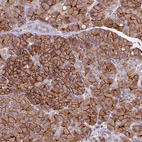 Anti-AQP8 Antibody