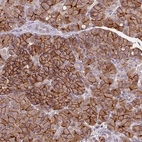 Immunohistochemical staining of human pancreas shows strong membranous positivity in exocrine glandular cells.