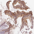 Immunohistochemical staining of human colon shows strong membranous positivity in glandular cells.