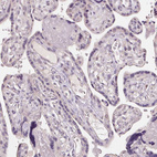 Anti-AQP8 Antibody