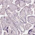 Immunohistochemical staining of human placenta shows no positivity in trophoblastic cells as expected.