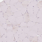 Immunohistochemical staining of human skeletal muscle shows no positivity in myocytes as expected.