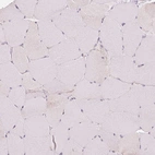 Immunohistochemical staining of human skeletal muscle shows no positivity in myocytes as expected.