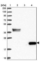 Lane 1: Marker [kDa] 250, 130, 95, 72, 55, 36, 28, 17, 10_br/_Lane 2: Human cell line RT-4_br/_Lane 3: Human cell line U-251MG sp_br/_Lane 4: Human plasma (IgG/HSA depleted)