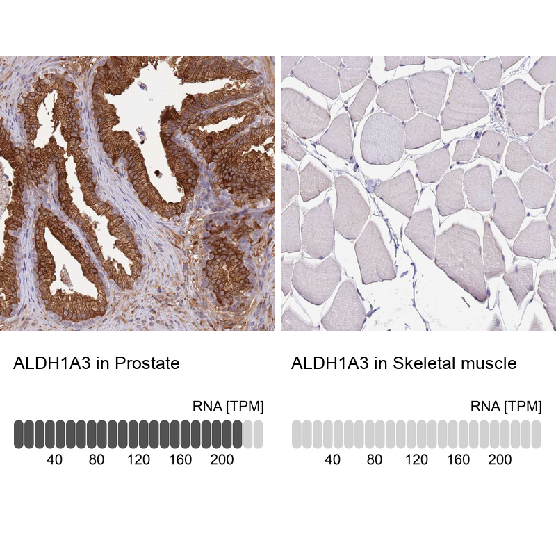 Anti-ALDH1A3 Antibody