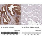 Anti-ALDH1A3 Antibody