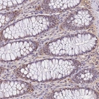 Immunohistochemical staining of human colon shows moderate cytoplasmic positivity in glandular cells.
