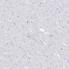 Immunohistochemical staining of human hypothalamus shows moderate positivity in neuronal cell projections.
