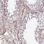 Immunohistochemical staining of human testis shows moderate cytoplasmic positivity in cells in seminiferous ducts.