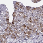 Immunohistochemical staining of human adrenal gland shows strong cytoplasmic positivity in glandular cells in adrenal medulla.