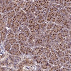 Anti-HPS3 Antibody