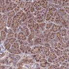 Anti-HPS3 Antibody