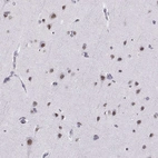 Immunohistochemical staining of human cerebral cortex shows moderate nuclear positivity in neuronal cells.
