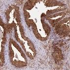 Immunohistochemical staining of human prostate shows strong cytoplasmic positivity in glandular cells.