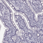 Immunohistochemical staining of human small intestine shows no cytoplasmic positivity in glandular cells as expected.