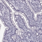Immunohistochemical staining of human small intestine shows no cytoplasmic positivity in glandular cells as expected.