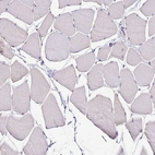 Immunohistochemical staining of human skeletal muscle shows no positivity in myocytes.