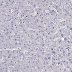 Immunohistochemical staining of human liver shows no cytoplasmic positivity in hepatocytes as expected.