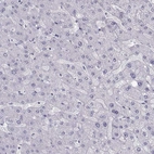 Immunohistochemical staining of human liver shows no cytoplasmic positivity in hepatocytes as expected.