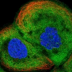 Immunofluorescent staining of human cell line A-431 shows positivity in plasma membrane & cytoplasm.