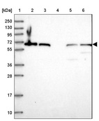 Lane 1: Marker [kDa] 250, 130, 95, 72, 55, 36, 28, 17, 10_br/_Lane 2: Human cell line RT-4_br/_Lane 3: Human cell line U-251MG sp_br/_Lane 4: Human plasma (IgG/HSA depleted)_br/_Lane 5: Human liver tissue_br/_Lane 6: Human tonsil tissue