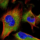 Immunofluorescent staining of human cell line U-251 MG shows localization to cytosol.