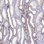 Anti-ACSM1 Antibody