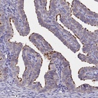 Anti-CCDC189 Antibody