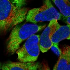 Immunofluorescent staining of human cell line HEK 293 shows localization to cytosol.