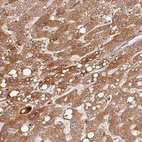 Anti-PGLYRP2 Antibody