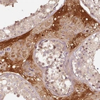 Immunohistochemical staining of human testis shows strong extracellular space positivity in Leydig cells.