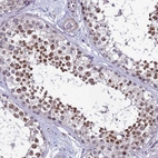 Immunohistochemical staining of human testis shows moderate nuclear positivity in cells in seminiferous ducts.