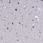 Immunohistochemical staining of human cerebral cortex shows moderate nuclear positivity in neurons.