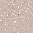 Immunohistochemical staining of human cerebral cortex shows no positivity in neurons as expected.