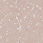 Immunohistochemical staining of human cerebral cortex shows no positivity in neurons as expected.