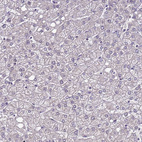 Anti-C19orf47 Antibody